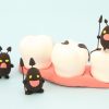 顎ニキビは虫歯が原因って本当？